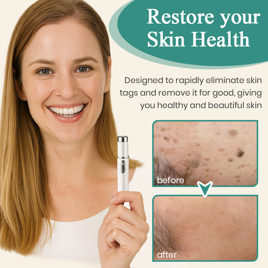 DAFEILA® LumeSkin Mole and Wart Instant Removal Laser Pen 7