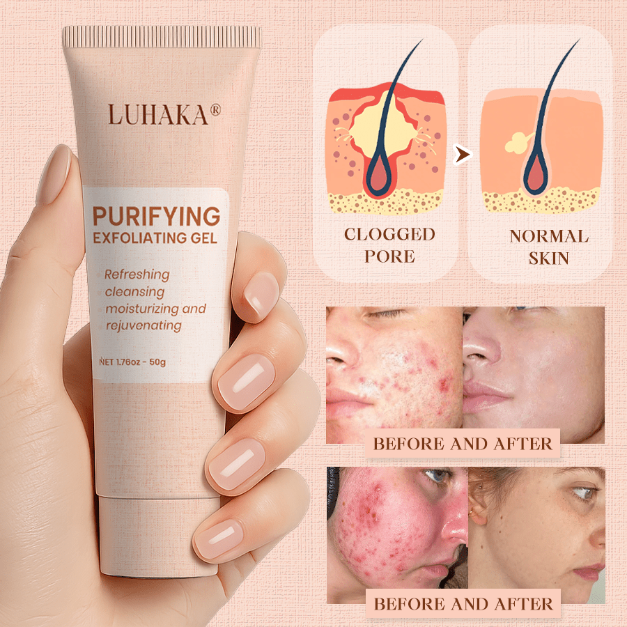 Luhaka® Purifying Exfoliating Gel for Acanthosis Nigricans, Exfoliation, Dark Spots, Skin Tags, and Eczema 🎁