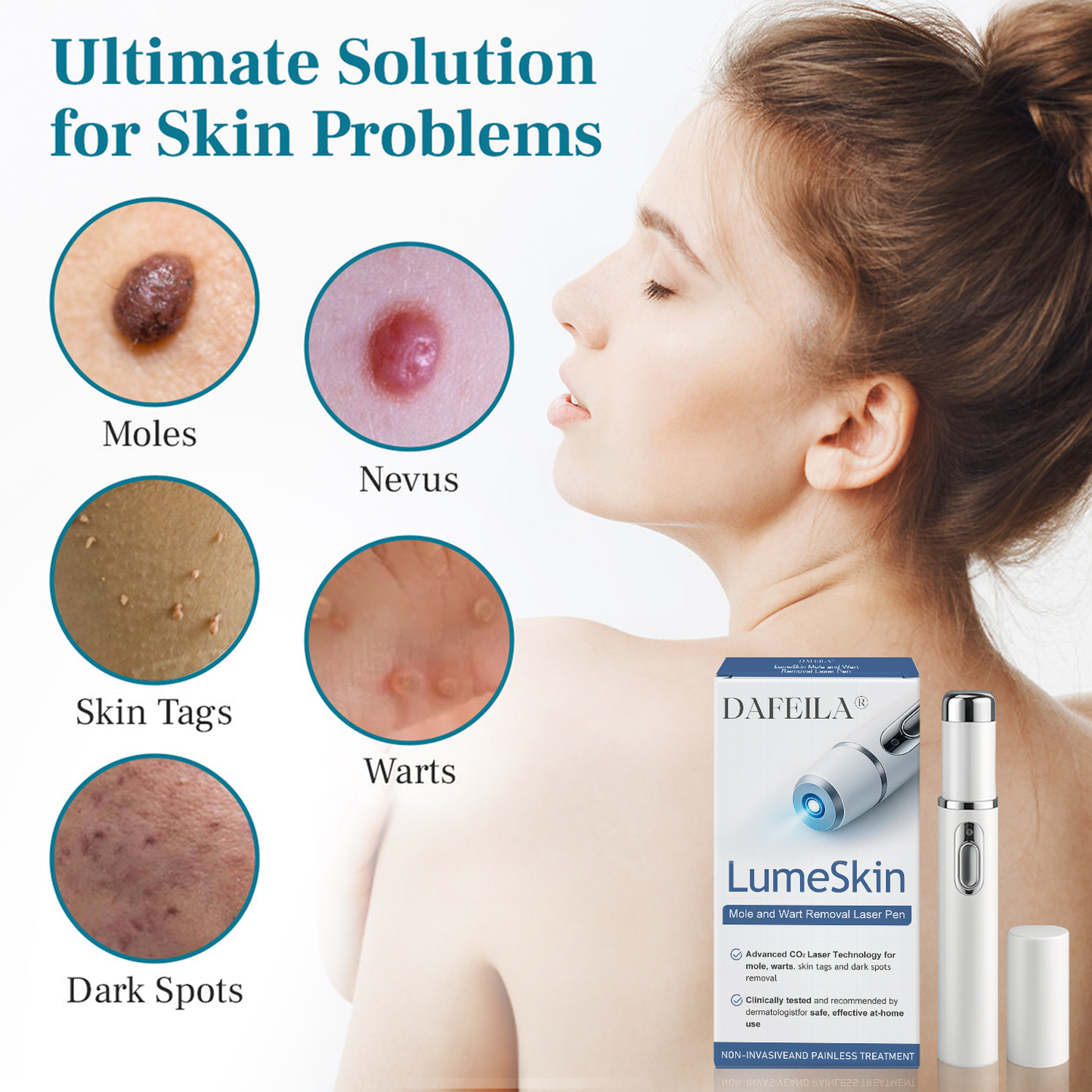 DAFEILA® LumeSkin Mole and Wart Removal Laser Pen 💙 7