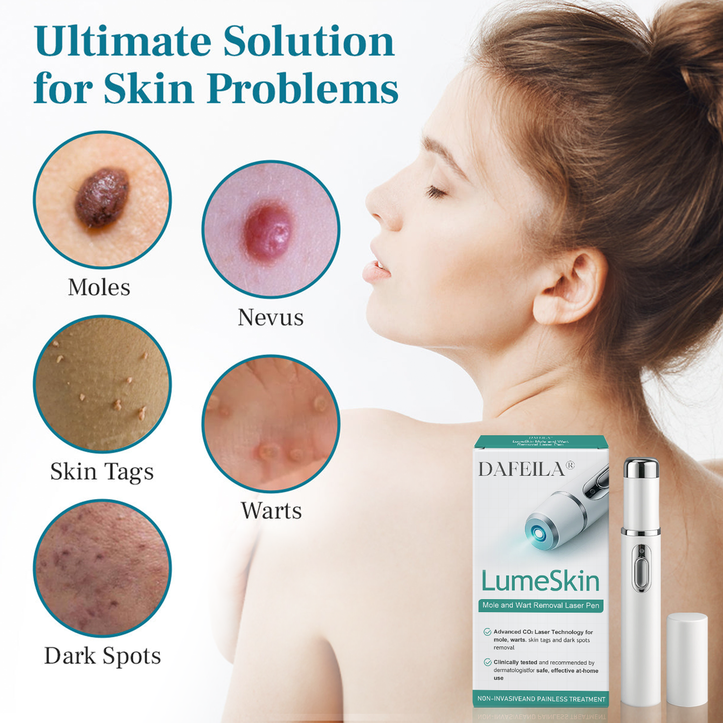 DAFEILA® LumeSkin Mole and Wart Removal Laser Pen 🟢2
