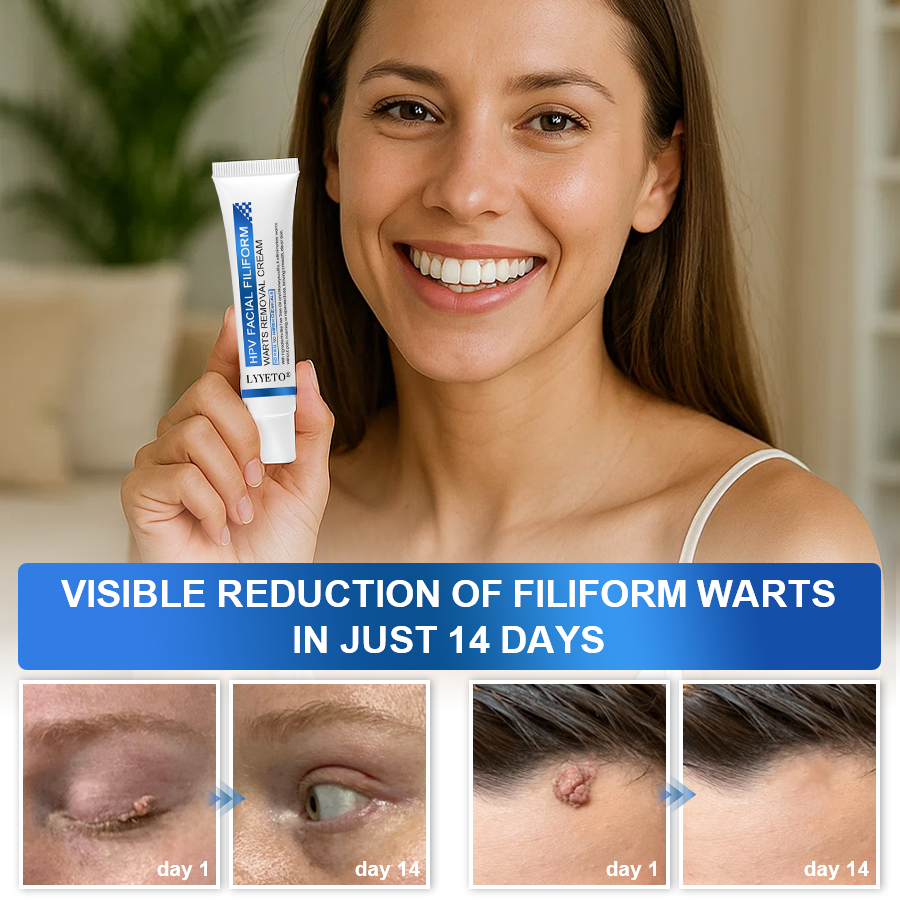 LYYETO® HPV Facial Filiform Warts Removal Cream ACE