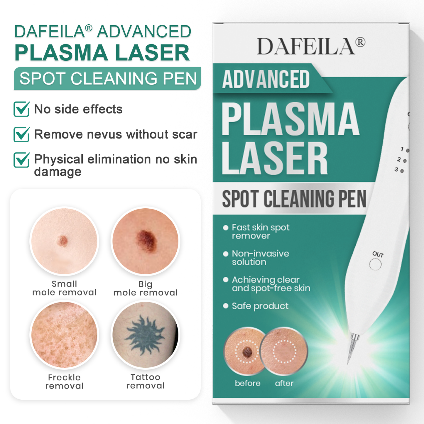 Dafeila® Advanced Plasma Laser Spot Cleaning Pen 🎉