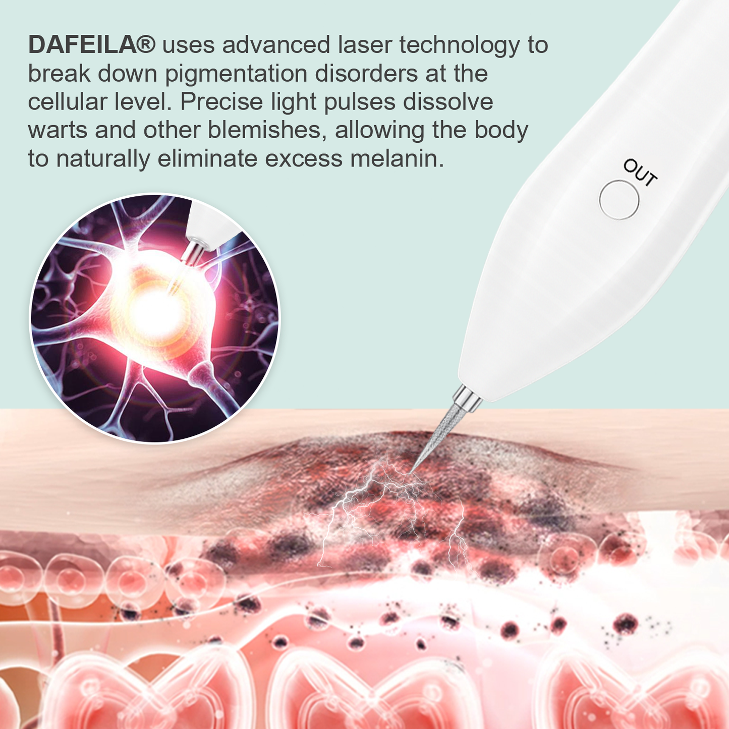 Dafeila® Advanced Plasma Laser Spot Cleaning Pen 🎉