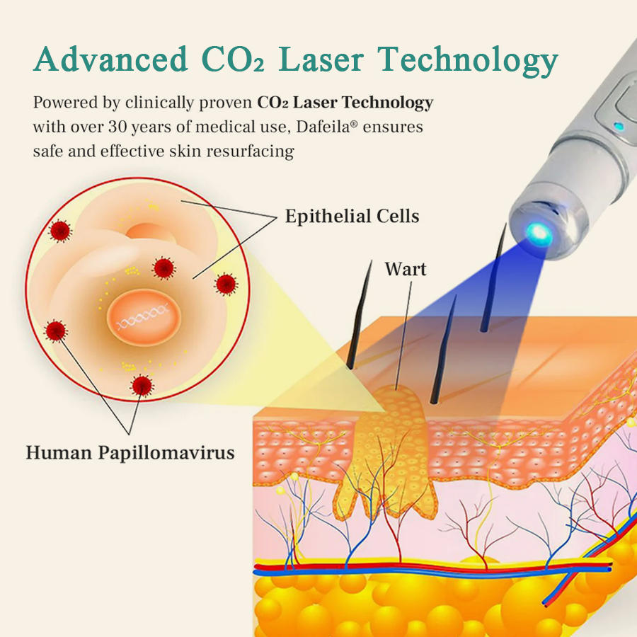 DAFEILA® LumeSkin Mole and Wart Instant Removal Laser Pen 7