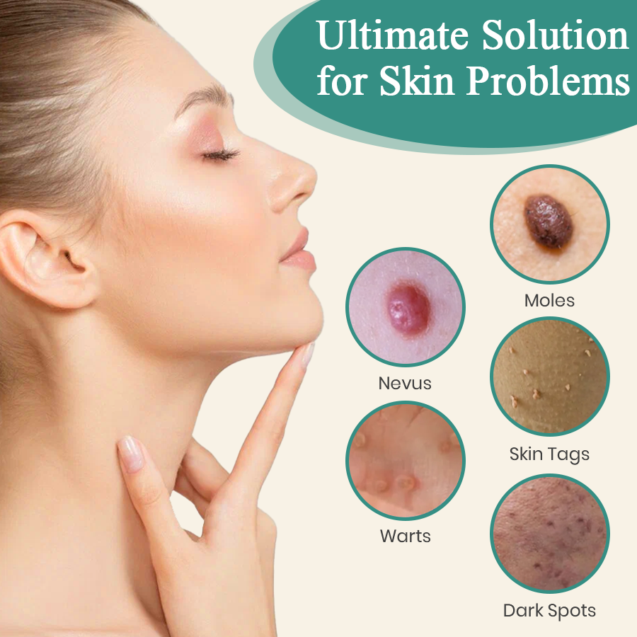 DAFEILA® LumeSkin Mole and Wart Instant Removal Laser Pen 7