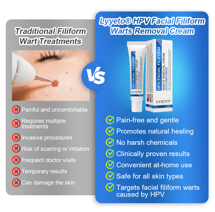 LYYETO® HPV Facial Filiform Warts Removal Cream ACE