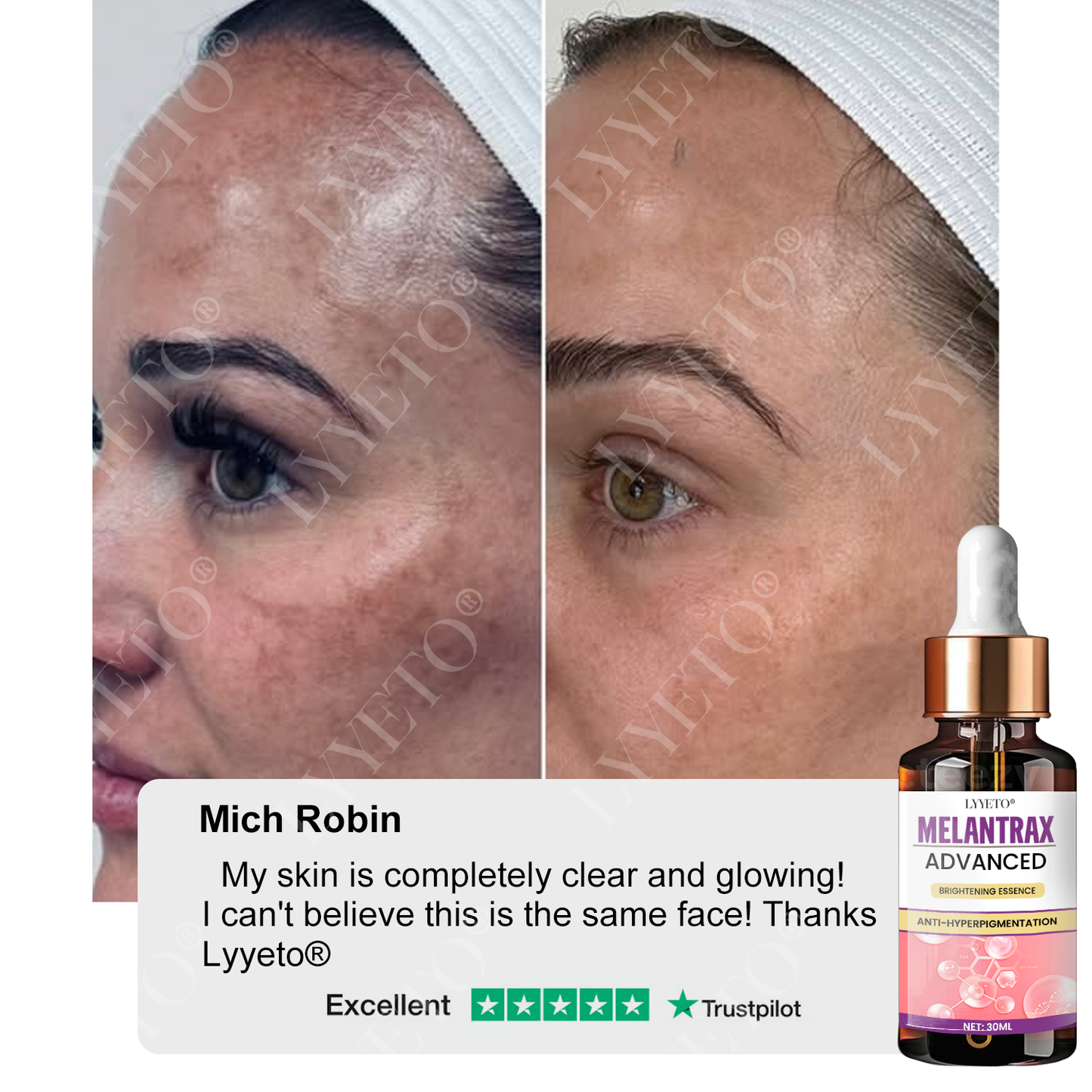 Lyyeto® MelantraX Advanced Brightening Essence