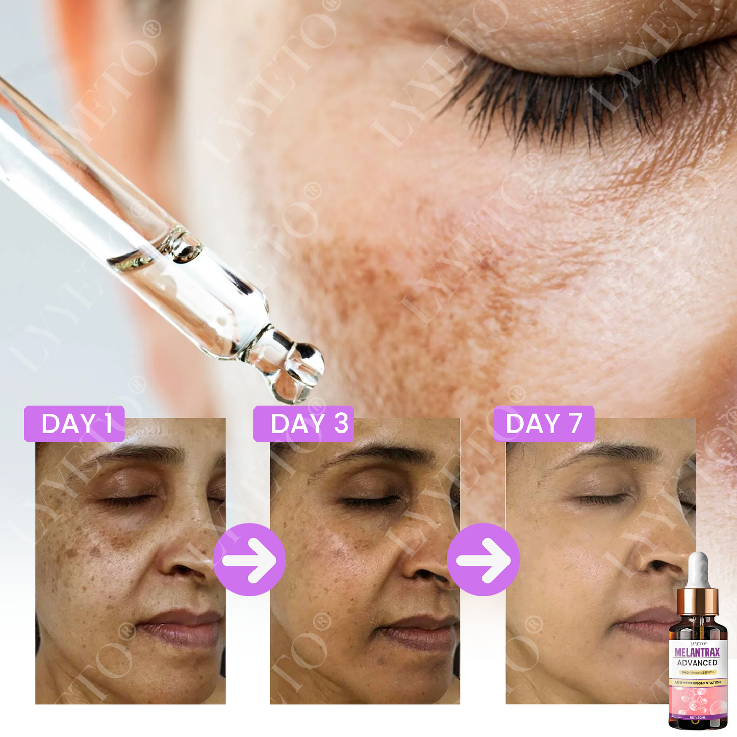 Lyyeto® MelantraX Advanced Brightening Essence