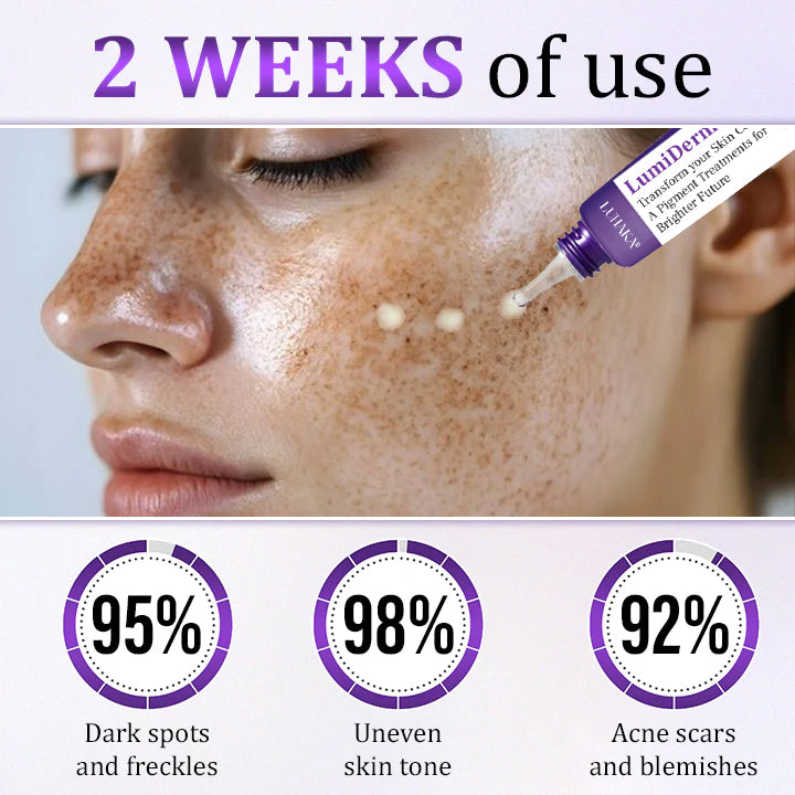 Luhaka® LumiDerma Anti-Hyperpigmentation Cream_Ultra01