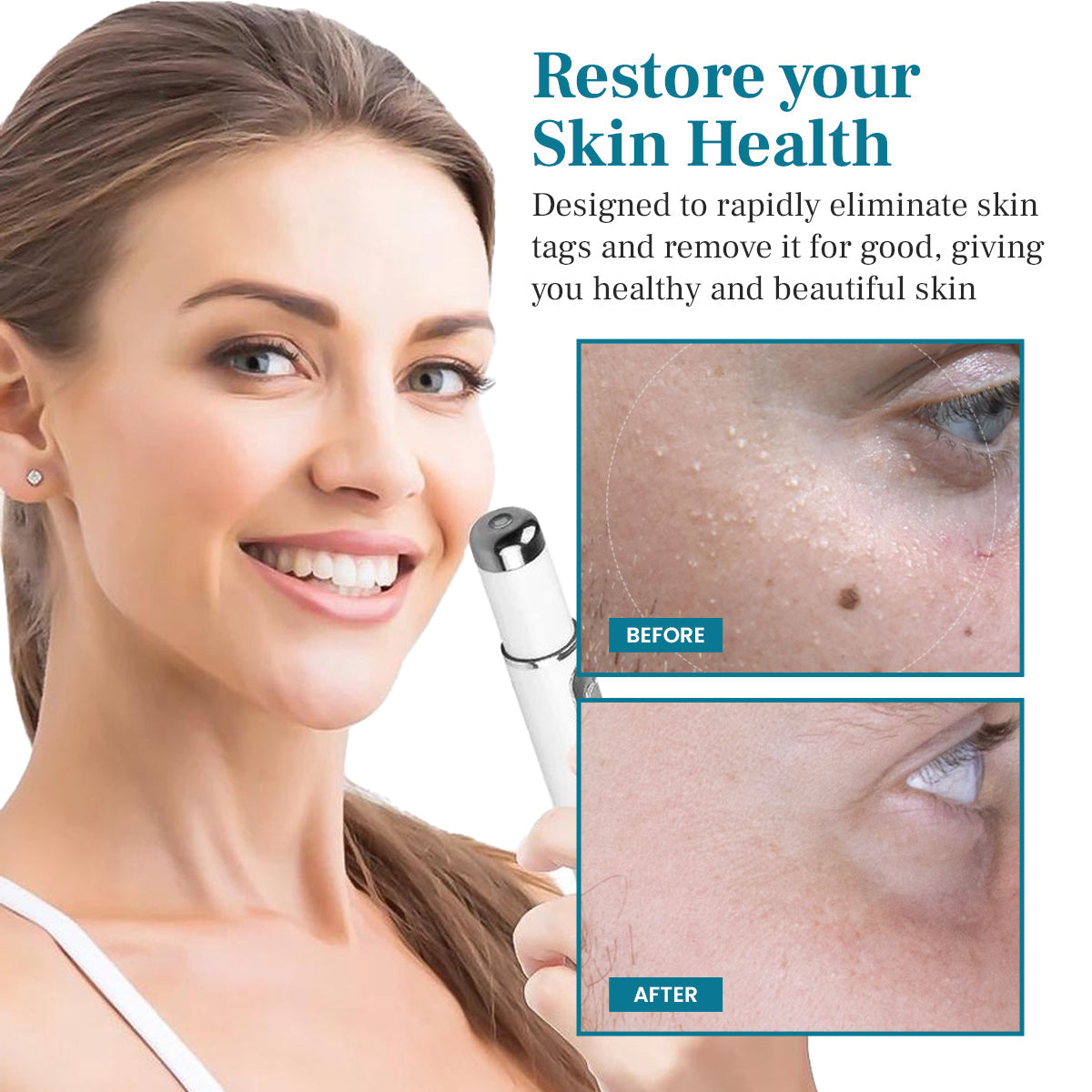 DAFEILA® LumeSkin Mole and Wart Removal Laser Pen 5
