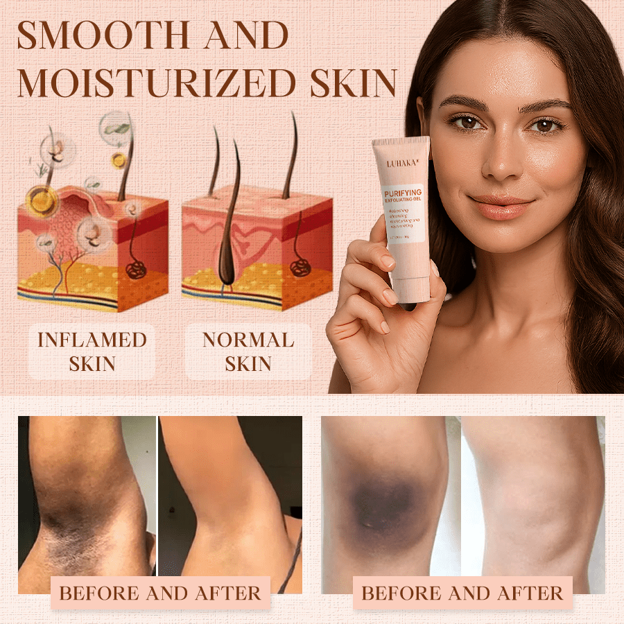 Luhaka® Purifying Exfoliating Gel for Acanthosis Nigricans, Exfoliation, Dark Spots, Skin Tags, and Eczema ❣️