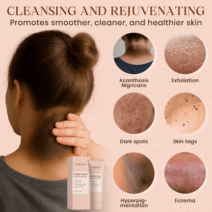 Luhaka® Purifying Exfoliating Gel for Acanthosis Nigricans, Exfoliation, Dark Spots, Skin Tags, and Eczema ❣️