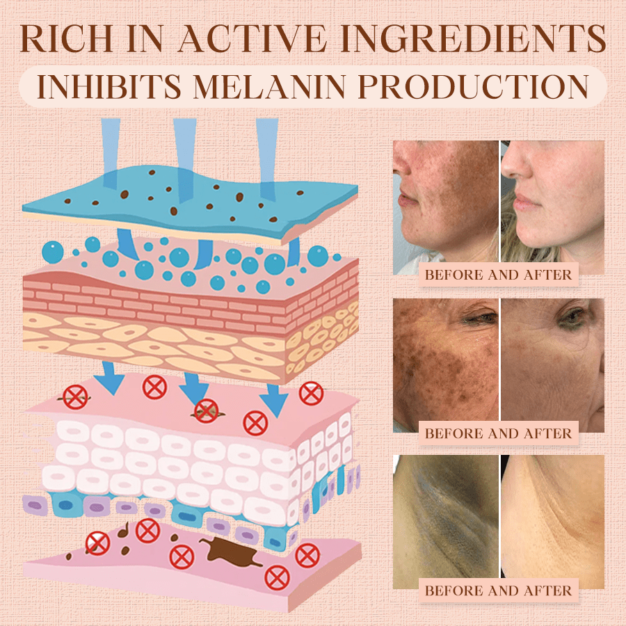 Luhaka® Purifying Exfoliating Gel for Acanthosis Nigricans, Exfoliation, Dark Spots, Skin Tags, and Eczema ❣️