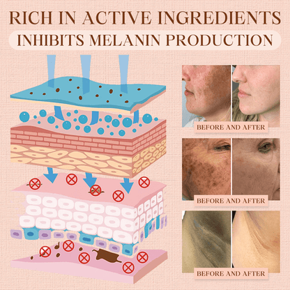 Luhaka® Purifying Exfoliating Gel for Acanthosis Nigricans, Exfoliation, Dark Spots, Skin Tags, and Eczema ❣️