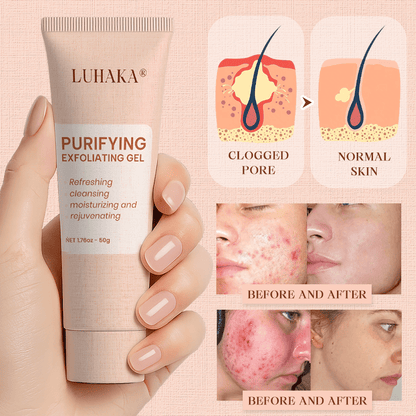 Luhaka® Purifying Exfoliating Gel for Acanthosis Nigricans, Exfoliation, Dark Spots, Skin Tags, and Eczema ❣️