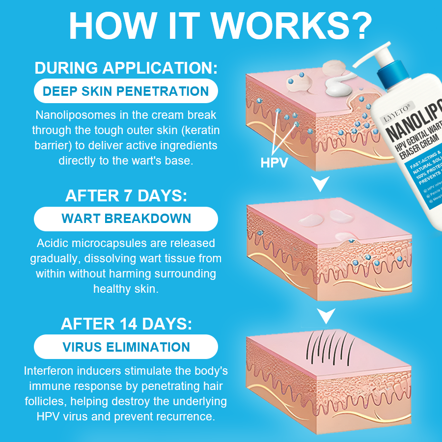LYYETO® NANOLIPO HPV GENITAL WARTS ERASER CREAM ACE 4