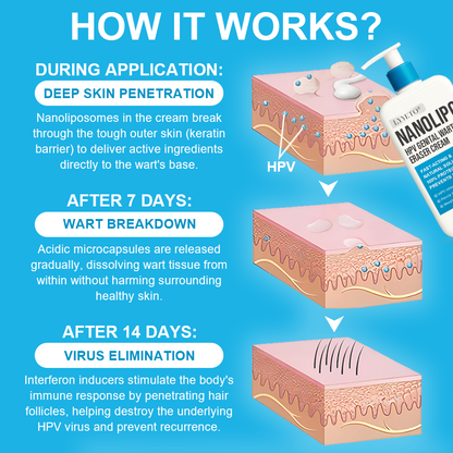 LYYETO® NANOLIPO HPV GENITAL WARTS ERASER CREAM ACE 4