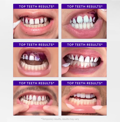 V34 Whitening Strips