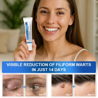 LYYETO® HPV Facial Filiform Warts Removal Cream ACE