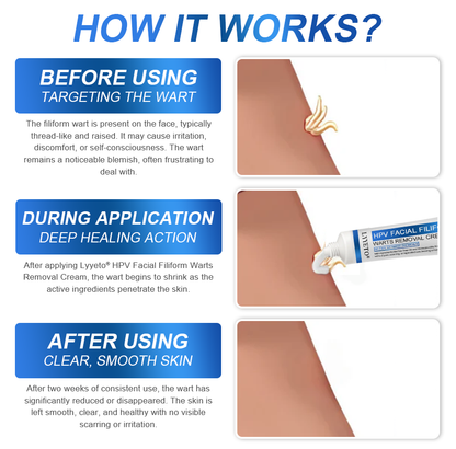 LYYETO® HPV Facial Filiform Warts Removal Cream ACE