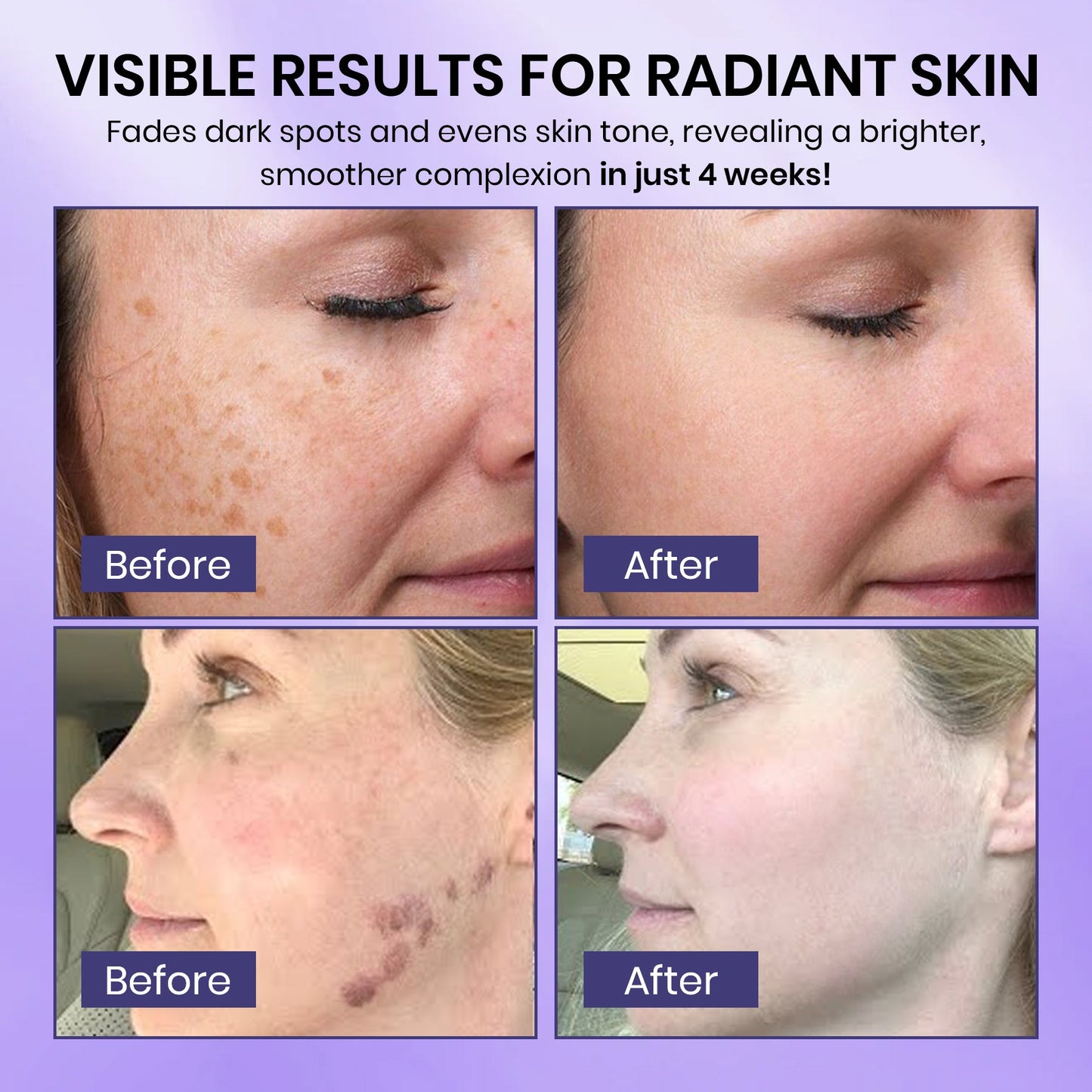 Luhaka® Radiglow  Brightening Dark Spot Gel 1