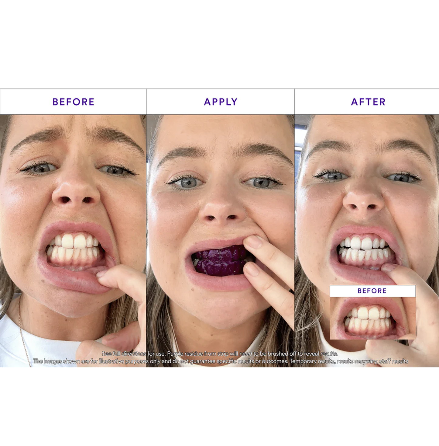 V34 Whitening Strips