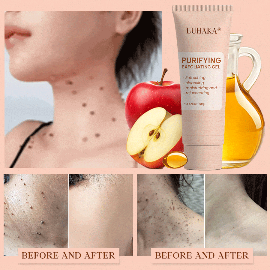 Luhaka® Purifying Exfoliating Gel for Acanthosis Nigricans, Exfoliation, Dark Spots, Skin Tags, and Eczema ❣️