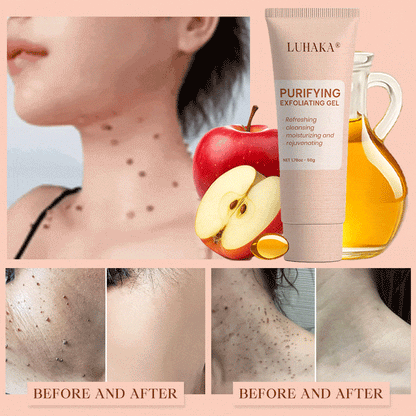 Luhaka® Purifying Exfoliating Gel for Acanthosis Nigricans, Exfoliation, Dark Spots, Skin Tags, and Eczema ❣️