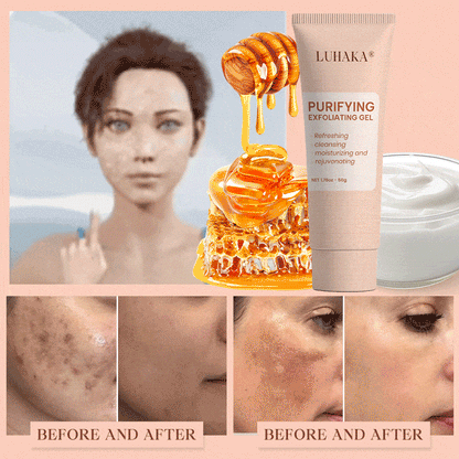 Luhaka® Purifying Exfoliating Gel for Acanthosis Nigricans, Exfoliation, Dark Spots, Skin Tags, and Eczema ❣️