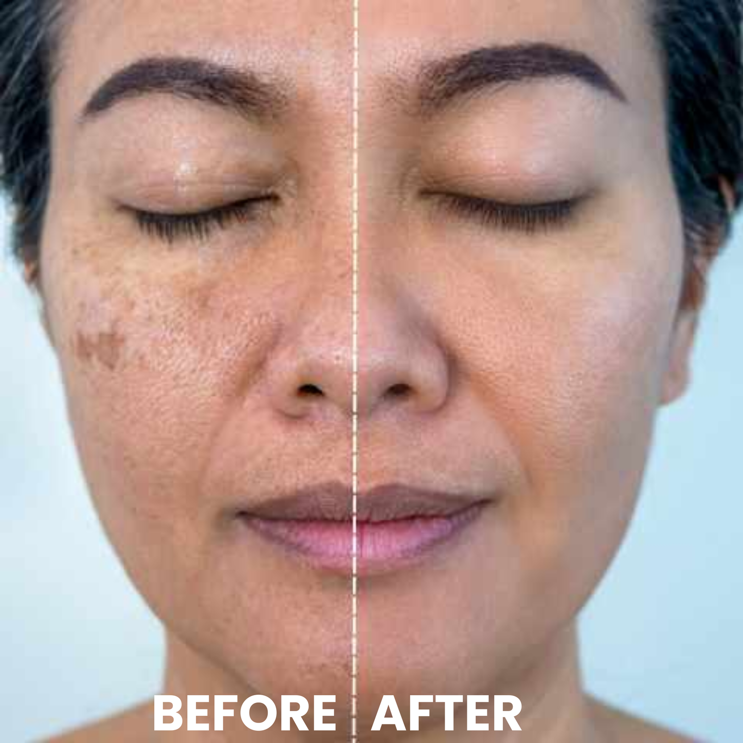 Luhaka® Ricerase Dual-Action Renewal Cream ACE