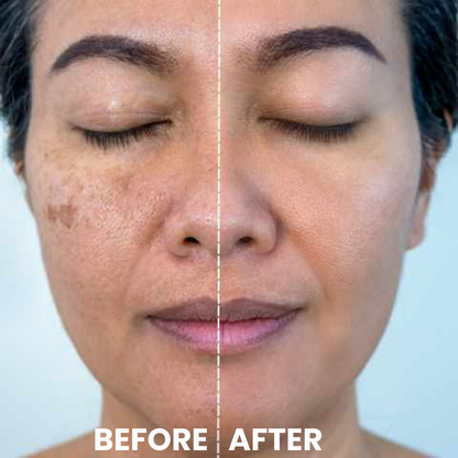 Luhaka® Ricerase Dual-Action Renewal Cream ACE
