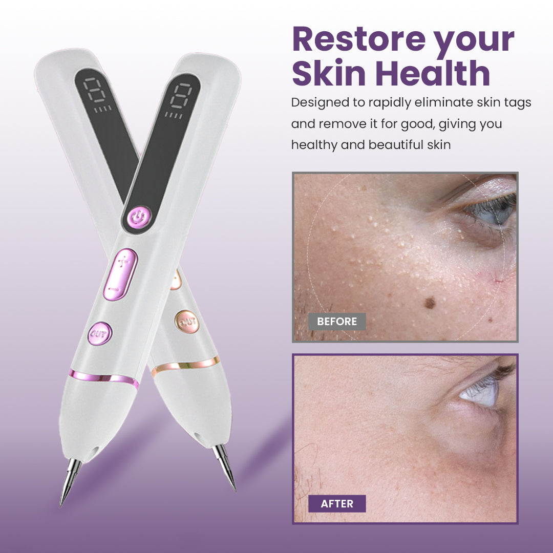 GORT Mole & Skin Tag Removal Pen