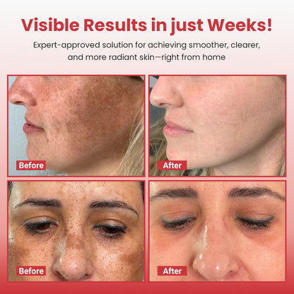 medloube Hypochlorous Acid Rice Peel Shot Duo ACE 1