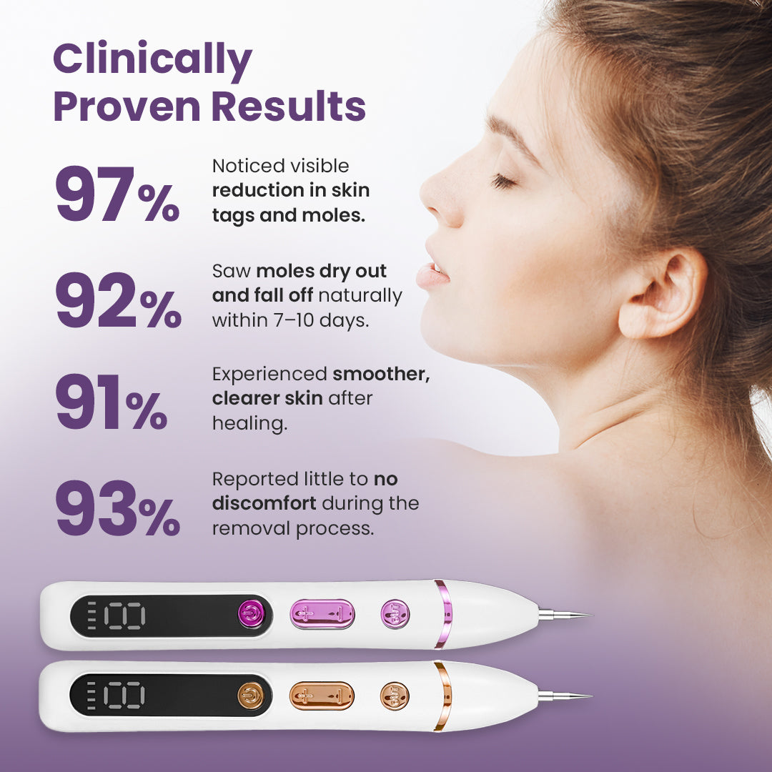 GORT Mole & Skin Tag Removal Pen